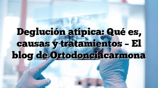 Deglución atípica: Qué es, causas y tratamientos – El blog de Ortodonciacarmona