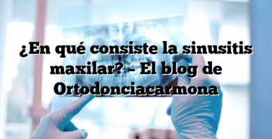 ¿En qué consiste la sinusitis maxilar? – El blog de Ortodonciacarmona