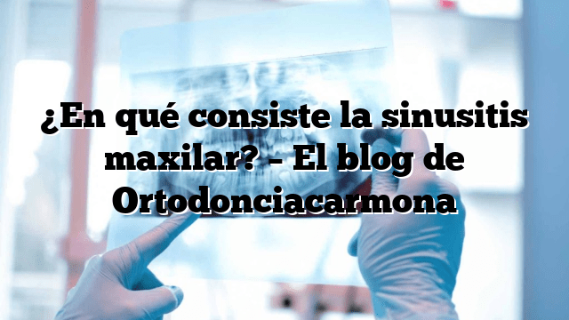 ¿En qué consiste la sinusitis maxilar? – El blog de Ortodonciacarmona
