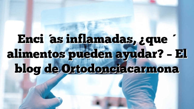 Encías inflamadas, ¿qué alimentos pueden ayudar? – El blog de Ortodonciacarmona