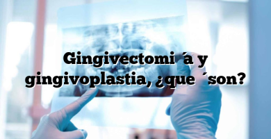 Gingivectomía y gingivoplastia, ¿qué son?