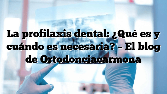 La profilaxis dental: ¿Qué es y cuándo es necesaria? – El blog de Ortodonciacarmona