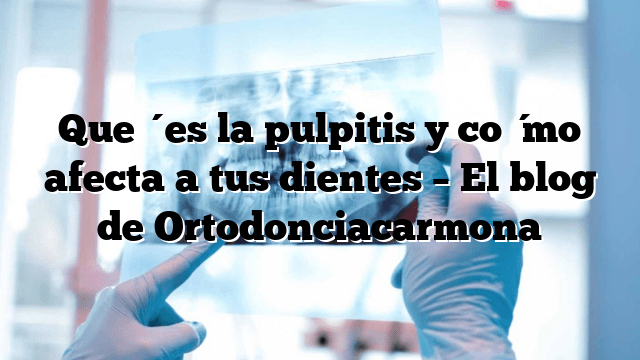 Qué es la pulpitis y cómo afecta a tus dientes – El blog de Ortodonciacarmona